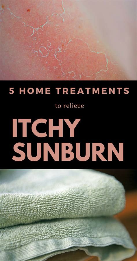 At Home Treatments Are The Most Effective For Sunburn Itch So Keep Reading And See What Works