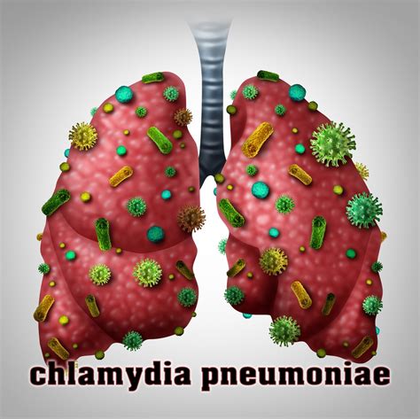 Chlamydia Pneumoniae Symptoms Types Diagnosis Treatment