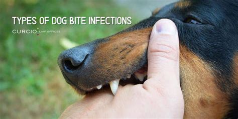 Types Of Dog Bite Infections Chicago Personal Injury Lawyers