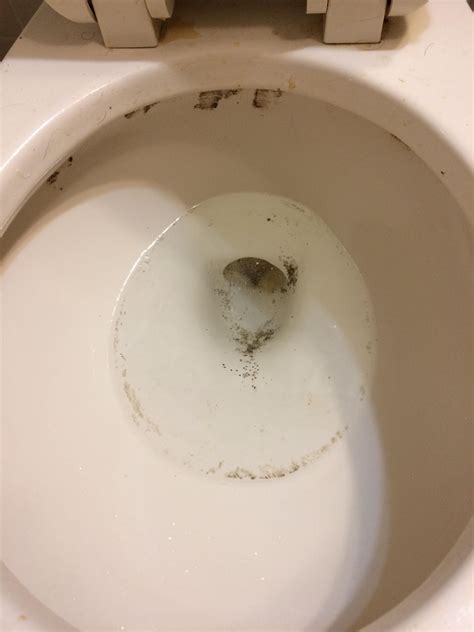 This Mold Has Been Growing In The Toilet Bow For About A Year And My Father Has Type Diabetes
