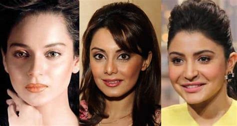 Anushka Sharma Kangana Ranaut And Other Bollywood Celebs Whose Plastic