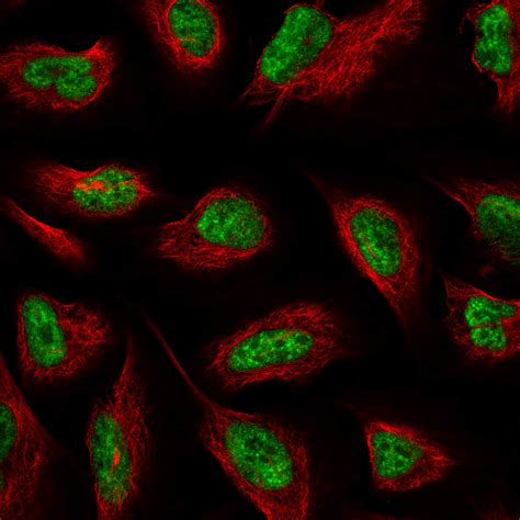 Cell Atlas Morf4l1 The Human Protein Atlas