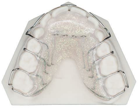 Removable Tongue Thrust Appliance Protec Dental