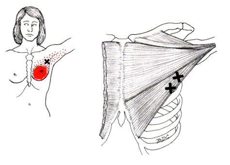 It acts on the shoulder and scapula, with its biggest role being shoulder horizontal adduction. Pin on Sănătate și fitness