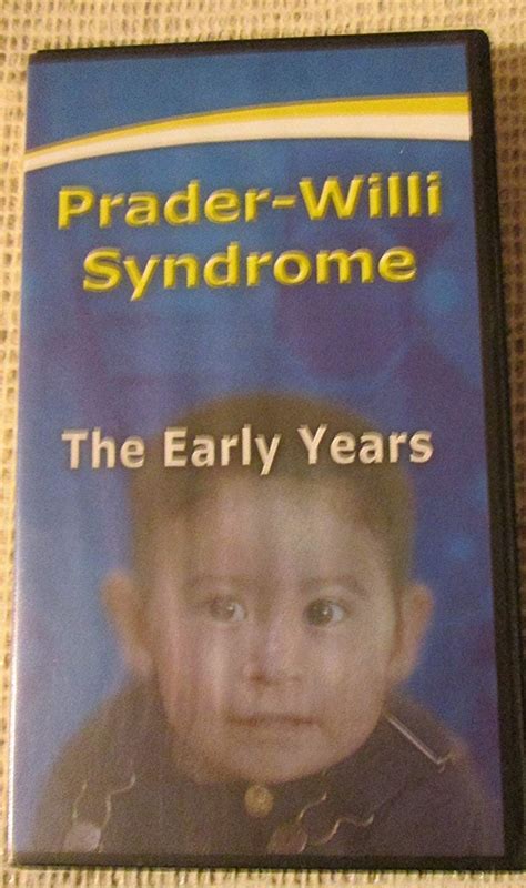 Buy Prader Willi Syndrome The Early Years Vhs Tape 2001 Online At