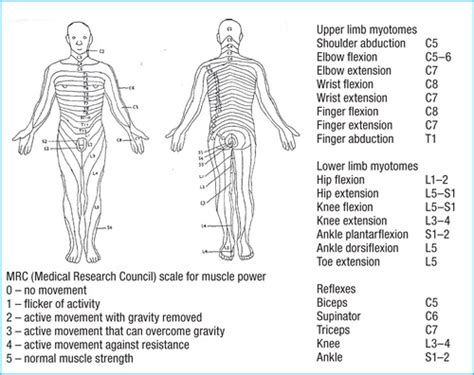 Dermatome Myotomes And Dtr Poster X Off