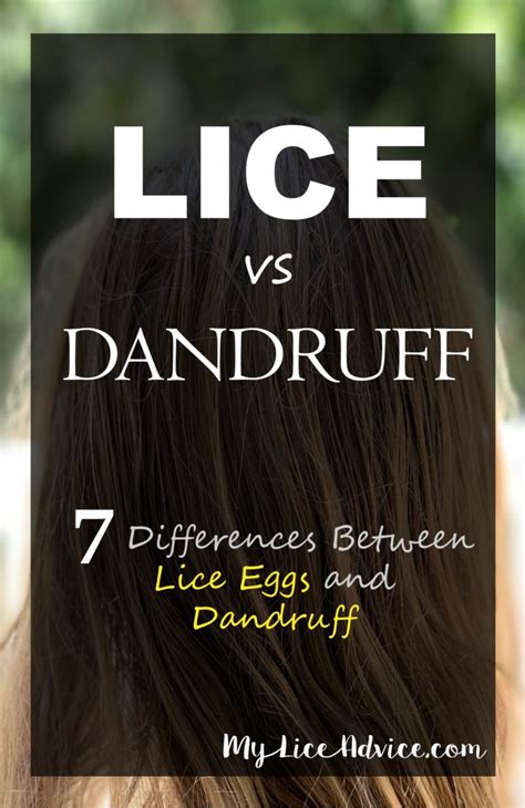 Lice Vs Dandruff 7 Key Differences Between Lice Eggs And Dandruff
