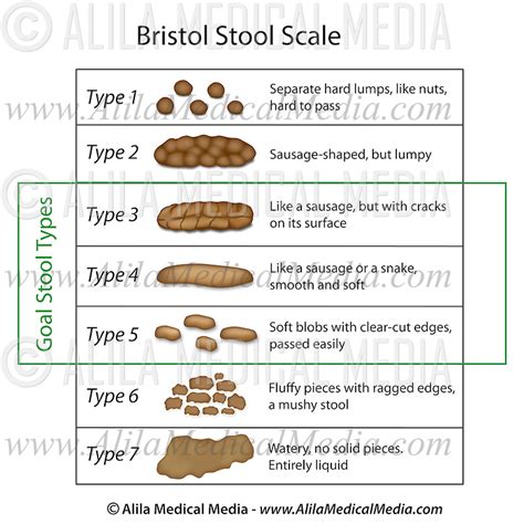 Bristol Stool Form Scale Poster Infection Prevention Control Images