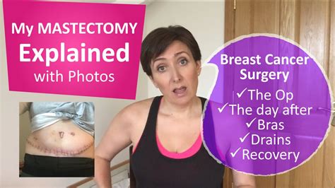 My Breast Cancer Lumpectomy Mastectomy And Reconstruction Youtube