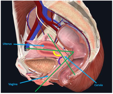 Anatomy Of The Uterus Female Reproductive Anatomy Geeky Medics