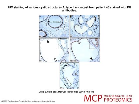 Ihc Staining Of Various Cystic Structures Ppt Download