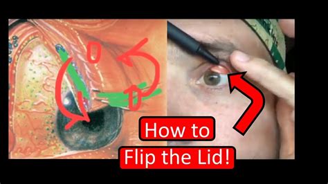 The clear craze of the 80's and 90's when everything was clear from staplers. "Eyelid Flip" : Flip Eyelid Youtube / The chronicles of trippytrap : - amazinglifeone