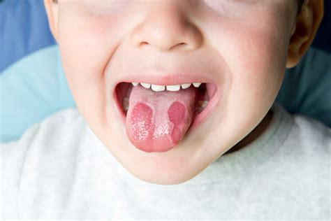 Chingum — Discover Curiosities The Cracks On The Tongue And Is It