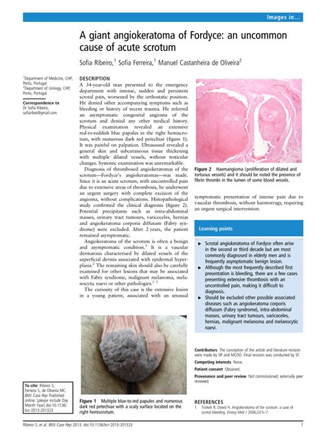 Pdf A Giant Angiokeratoma Of Fordyce An Uncommon Cause Of Acute Scrotum