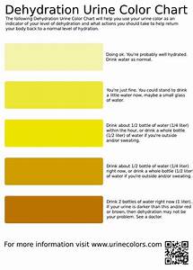 Dehydration Urine Color Chart Color Of Urine Infographic Health