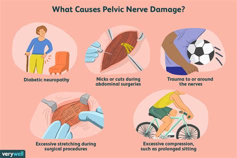 Pelvic Nerve Pain Symptoms Treatment And More