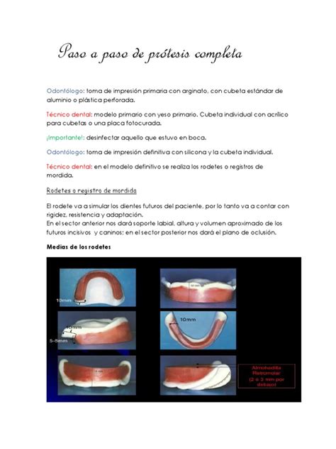 Paso A Paso De Prótesis Completa Diente Anatomia Dental
