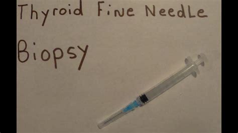 Thyroid Fine Needle Biopsy Youtube