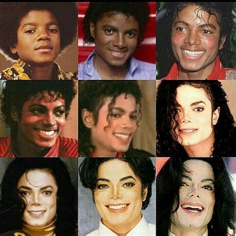 Michael Jackson S Plastic Surgery Journey Vanity