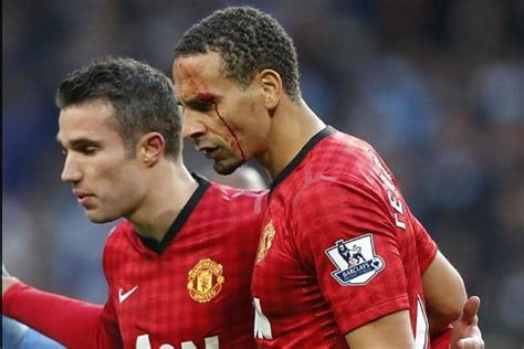 Rio Ferdinand Is Bloodied But Manchester United Win Mint Primer