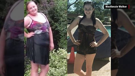 Anorexic Womans Dramatic Transformation Cnn Video