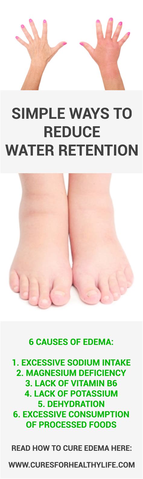 Kidney Fluid Retention Pregnancy Kidneyoi