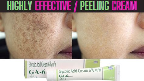 Glycolic Acid Peeling Cream Highly Effective Result Skin Whitening