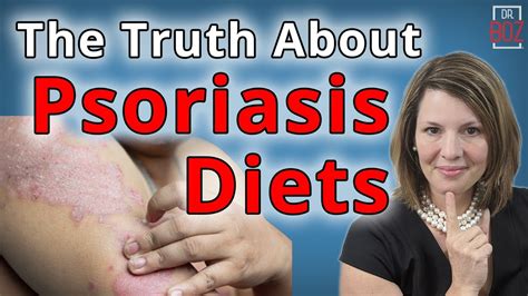 Understanding Psoriasis And The Truth About Psoriasis Diet Dr Boz