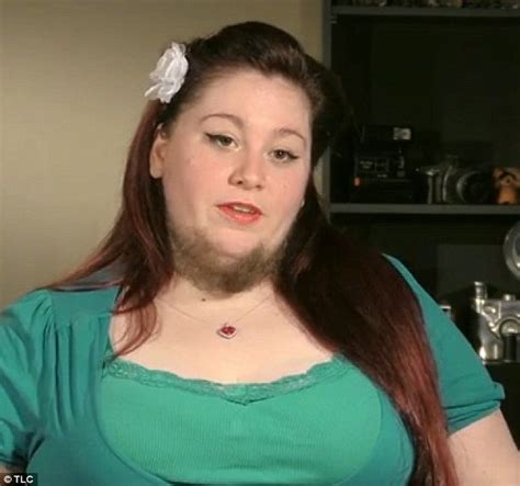 Brave Bearded Lady Ditches The Razor After Husband Says He Loves Her