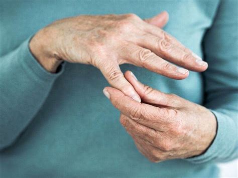 Osteoarthritis 10 Osteoarthritis Symptoms