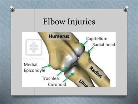 Ppt Injuries To The Elbow And Forearm Powerpoint