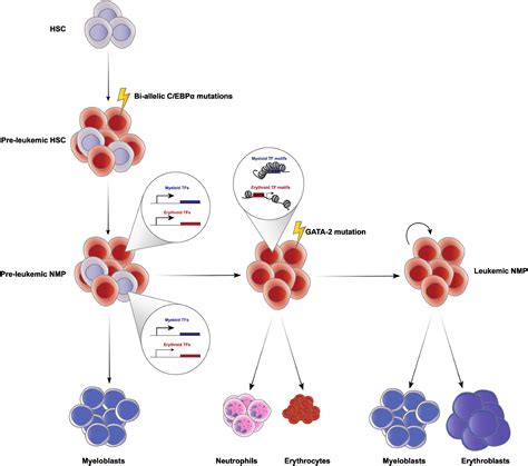 To Bi Or Not To Bi Acute Erythroid Leukemias And Hematopoietic Lineage