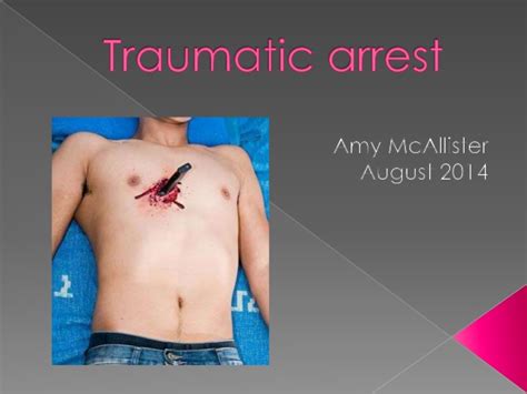 Approximately 350,000 people suffered cardiac arrest outside of a hospital in 2016, with a further 209,000 cardiac arrests occurring. Traumatic arrest