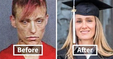 20 Inspiring Transformation Stories Of People Who Overcame Drug