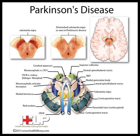 What Body Systems Are Affected By Parkinsons Disease