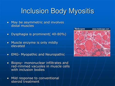 Inclusion Body Myositis Three Stages
