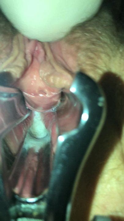 gf trying to cum with speculum opening pussy xhamster