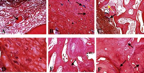 A Photomicrograph Of Control C Group Showing The Bony Defect