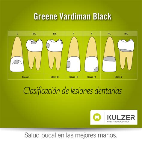 Greene Vardiman Black Kulzer México