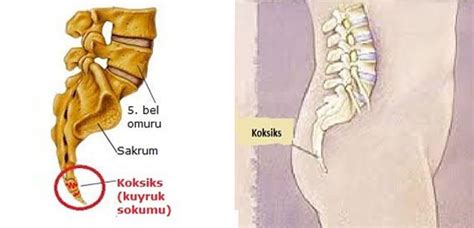 Kuyruk Sokumu Ağrısı (Koksigodini) – Prof. Dr. Levent Altınel | Antalya