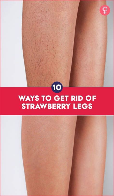 10 Ways To Get Rid Of Strawberry Legs The Term Strawberry Legs Refers