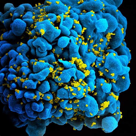 Cell Particles May Help Spread Hiv Infection Nih Study Suggests