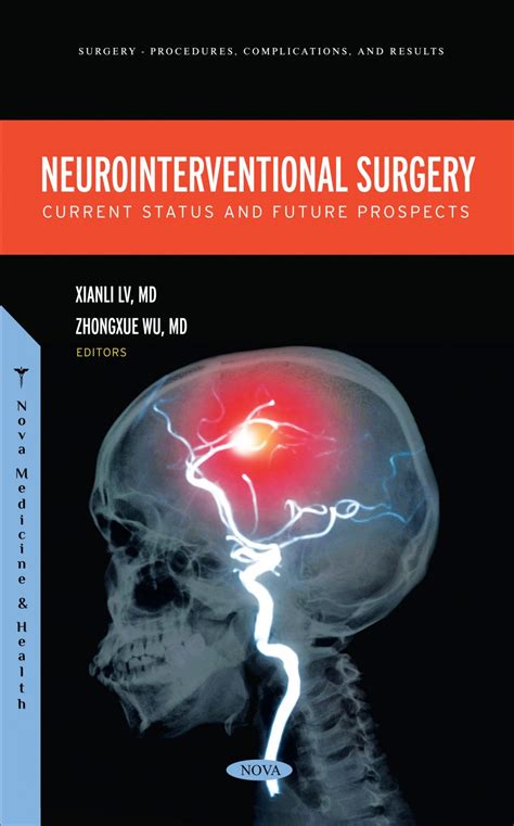 Neurointerventional Surgery Current Status And Future Prospects Nova