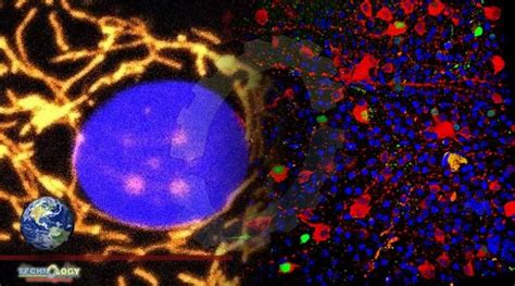 a new gene therapy for vision loss from a mitochondrial dysfunction