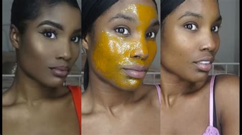 My Skin Care Routine And Turmeric Mask Acne Youtube