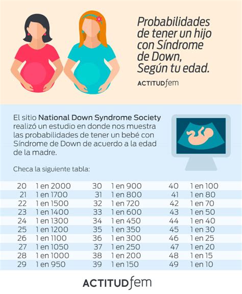 Las Probabilidades De Tener Un Bebé Con Síndrome De Down Según Tu Edad