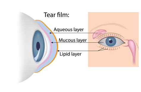 Dry Eye What It Is Isnt Optometric Physicians Of Middle Tennessee