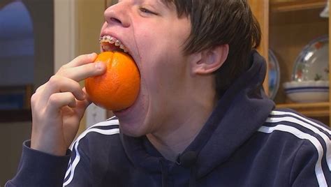 Minneapolis Teen Takes Another Bite Of Guinness World Record For