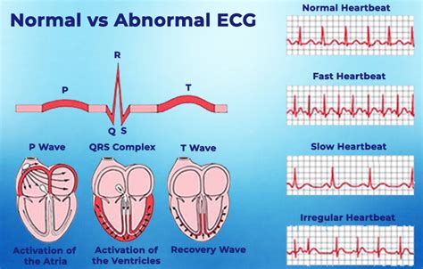 Echocardiogram Ecg In Dubai Best Cardiologist In Dubai Highgate