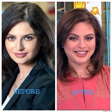 Brianna Golodryga Plastic Surgery Photos Before And After ⋆ Surgery4